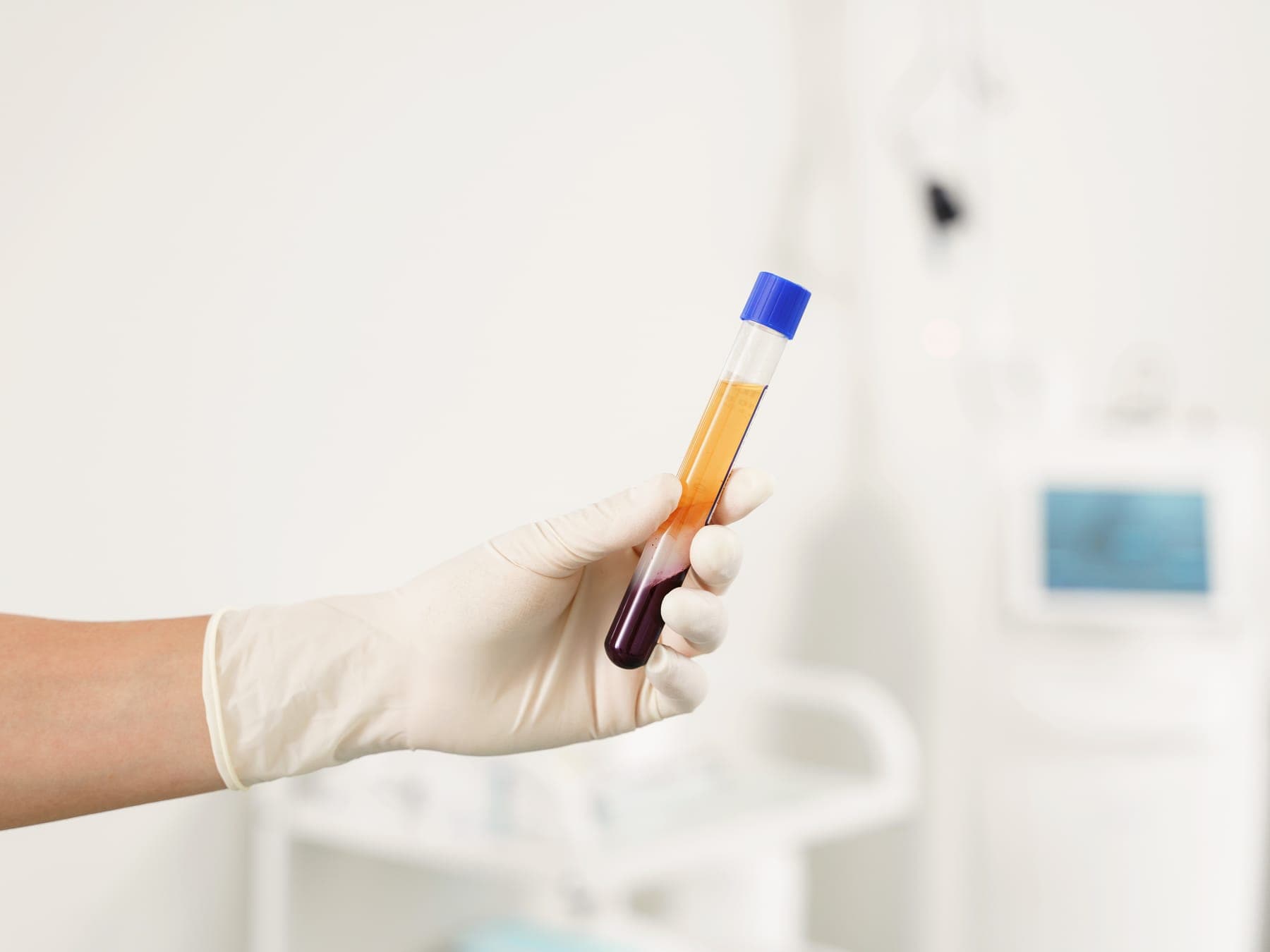 Tubo con sangre ya separada en sus componentes, sostenido con guantes