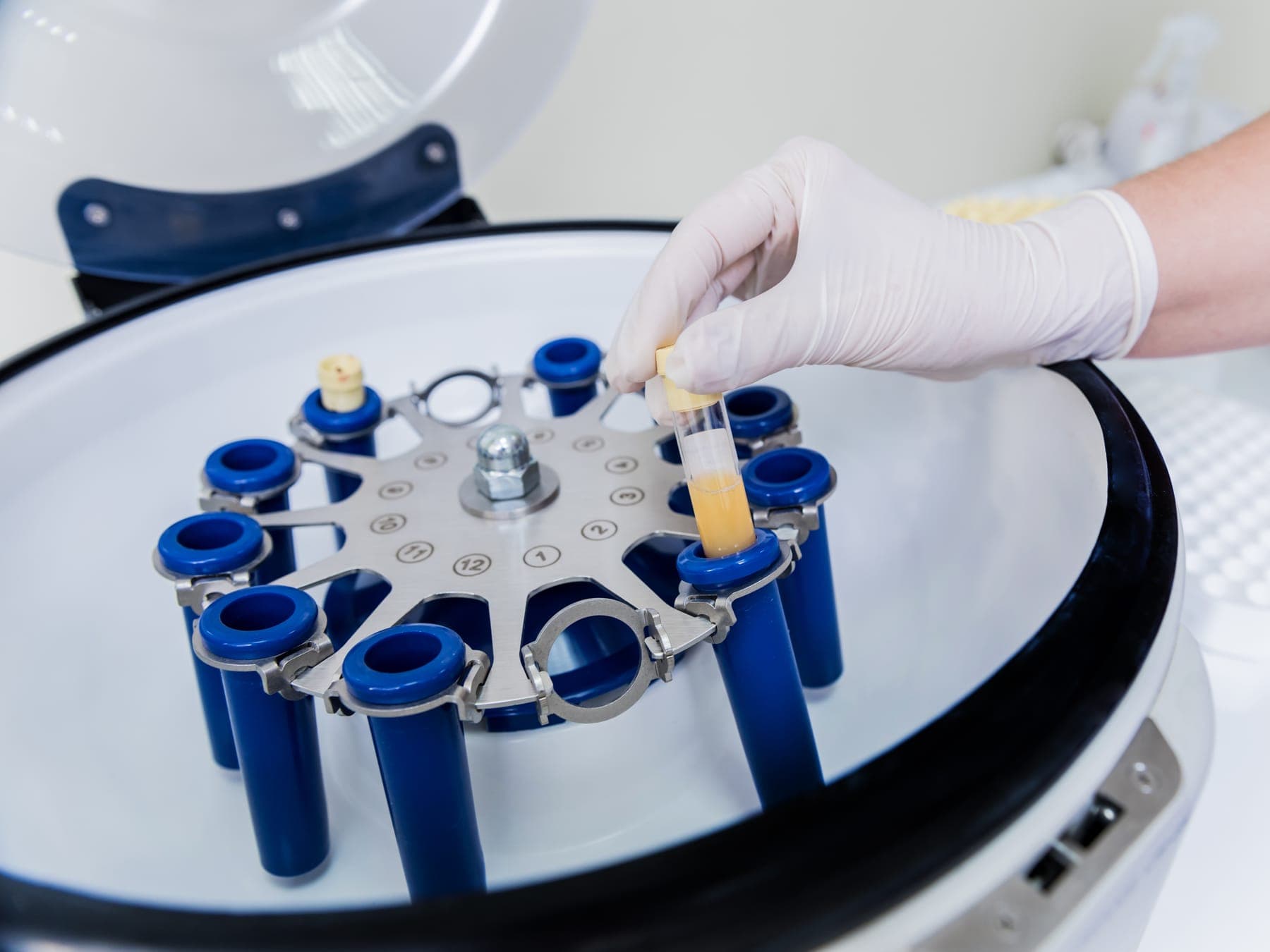 Muestras en una centrífuga de laboratorio durante la preparación del tratamiento