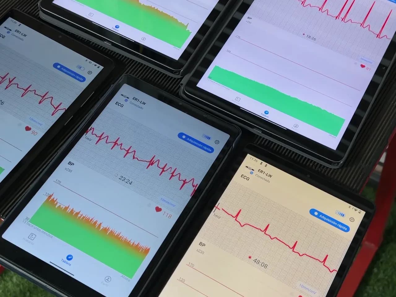 Tablets con electrocardiogramas en vivo durante una sesión de rehabilitación cardiovascular en SportsMD